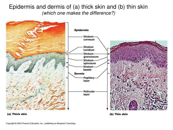 PPT - The Integumentary System PowerPoint Presentation - ID:5375574