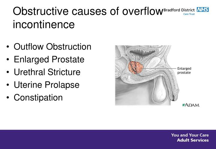 overflow incontinence cancer