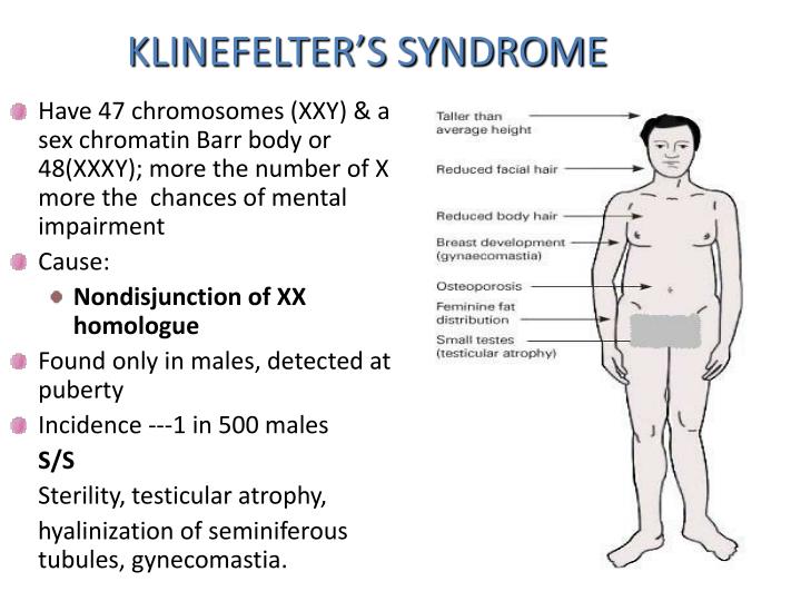 Klinefelter Syndrome Pictures