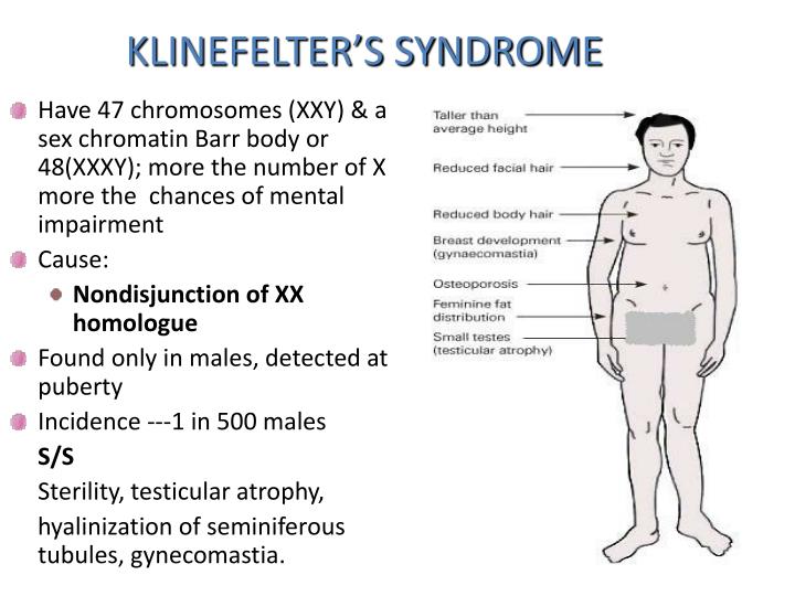 Klinefelters Syndrome Article Presentation 9019