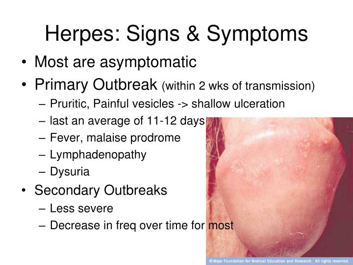 How Long Does The Herpes Virus Stay Alive On Surfaces at Robert Leduc blog