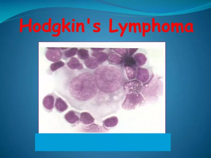 hodgkins disease essay hodgkins disease essay