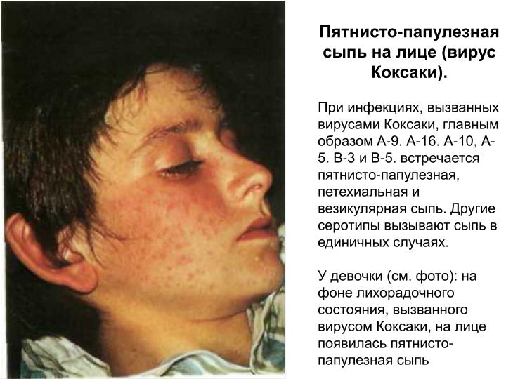МАОУ СОШ 135, г. Пермь Касторовое масло для волос, его применение в