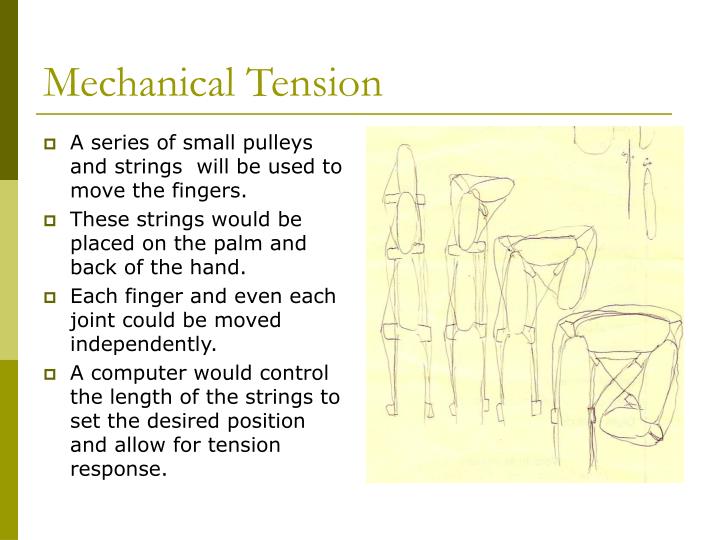 PPT Continuous Passive Motion Hand Rehabilitation PowerPoint