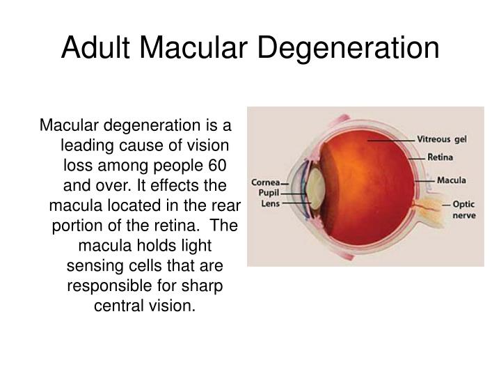 Effects Of Levitra On Macular Degeneration