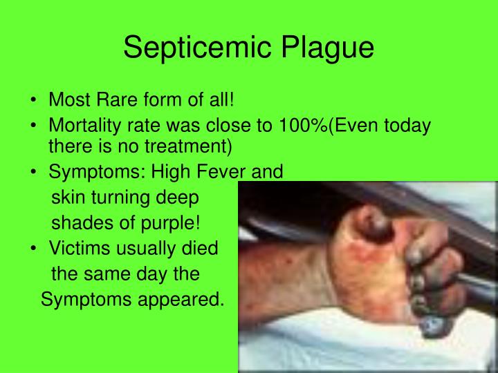 the history causes and symptoms of the bubonic plague Having no defense and no understanding of the cause of the the symptoms were not the same as in the the black death, 1348, eyewitness to history. the history causes and symptoms of the bubonic plague Having no defense and no understanding of the cause of the the symptoms were not the same as in the the black death, 1348, eyewitness to history.