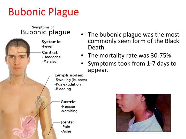 The gallery for > Bubonic Plague Symptoms Buboes