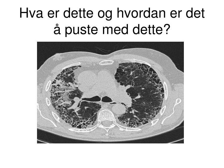 hva er en potens nakenbilder av justin bieber hva er en potens nakenbilder av justin bieber