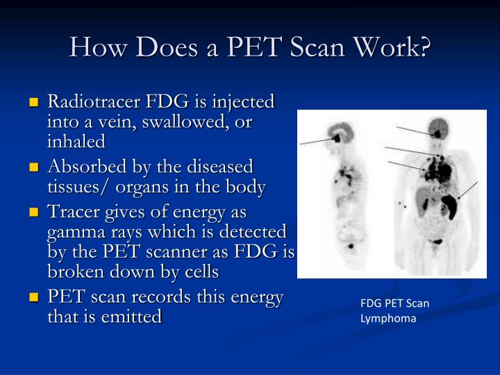 PPT Ultrasound PowerPoint Presentation ID 5961545 ppt-ultrasound-powerpoint-presentation-id-5961545
