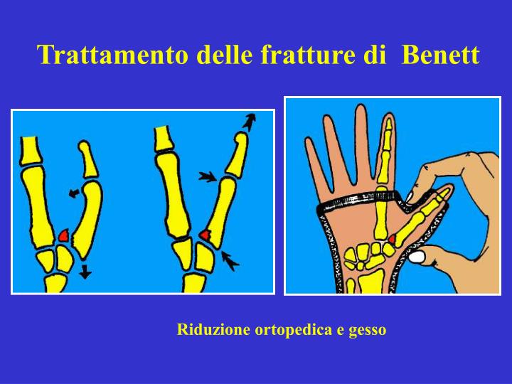 Quale dottore a dolori di vita e di dorso