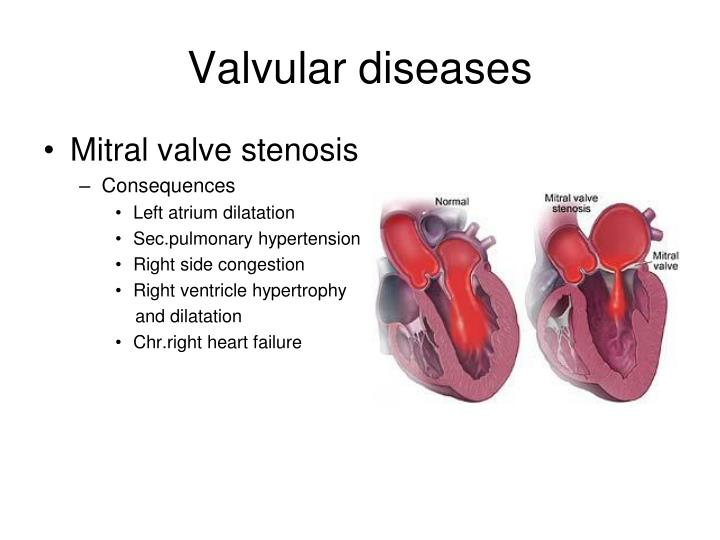 ppt-common-diseases-of-the-heart-and-circulatory-system-powerpoint