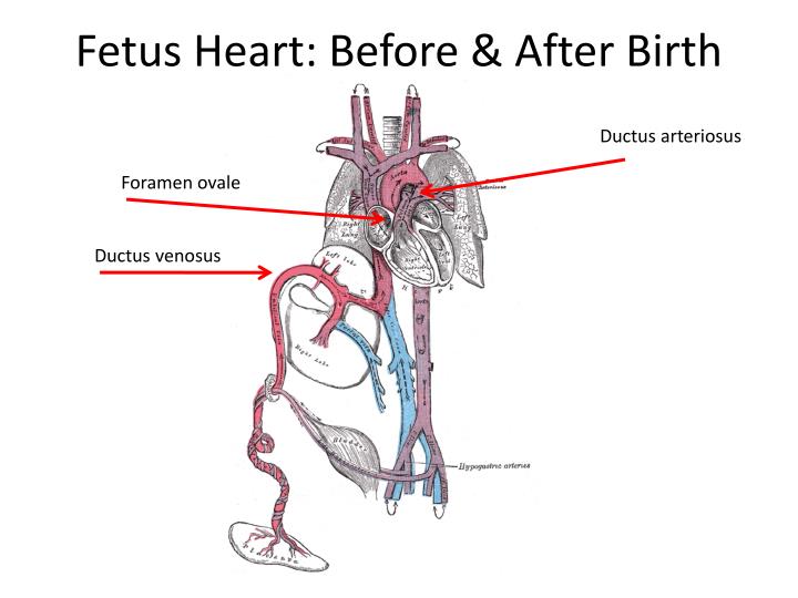 Ppt - Neonate Heart Powerpoint Presentation - Id:6116693