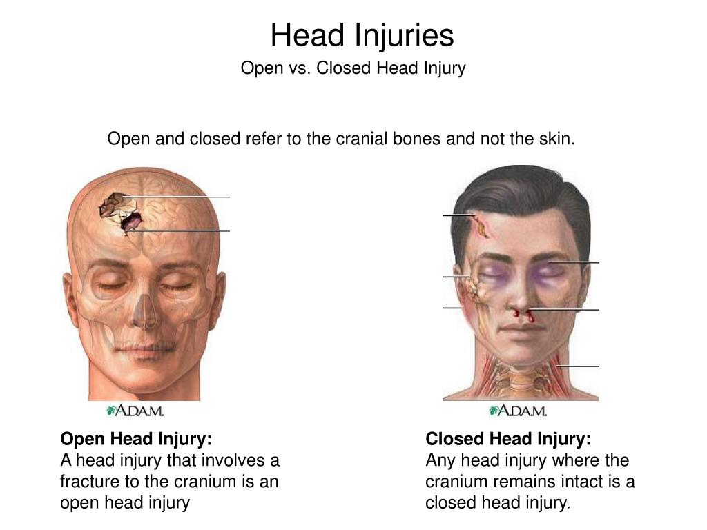 Facial injuries photos