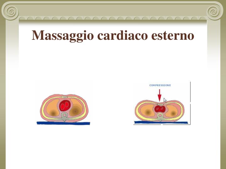 Osteochondrosis cervicale con il collo e il dolore principale