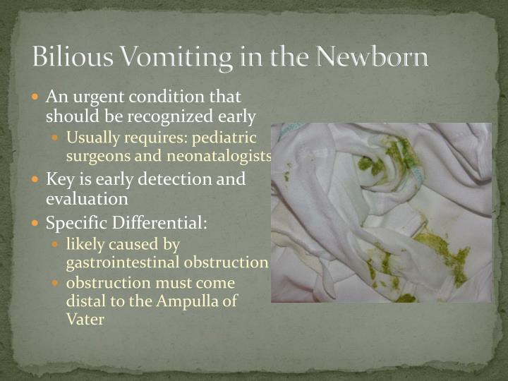 Ppt Neonatal Bilious Emesis Powerpoint Presentation Id6338342