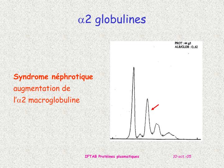 PPT - Pré-Albumine PowerPoint Presentation - ID:6386708