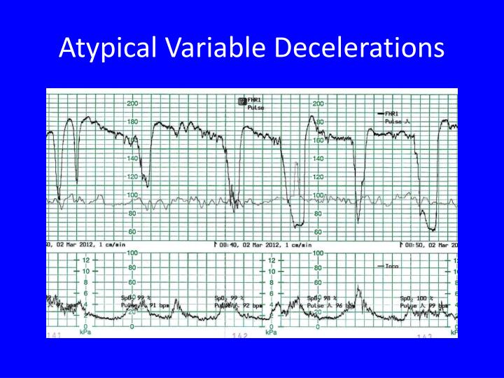 decelerate definition decelerate definition