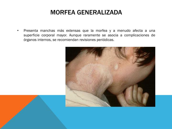 EL RINCN DE LA MEDICINA INTERNA: Imgenes de la Sala Morfea