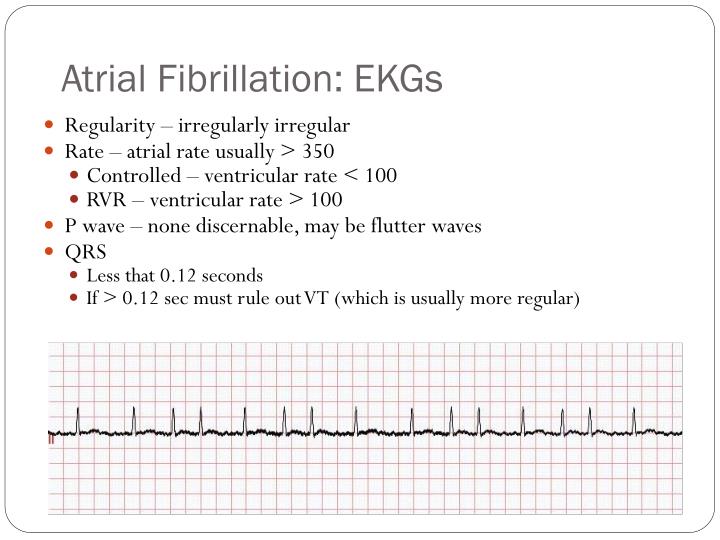 a flutter with rvr treatment a flutter with rvr treatment