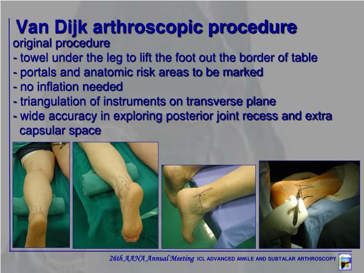 Ppt Advanced Ankle And Subtalar Arthroscopy Use Of Medial Portals In