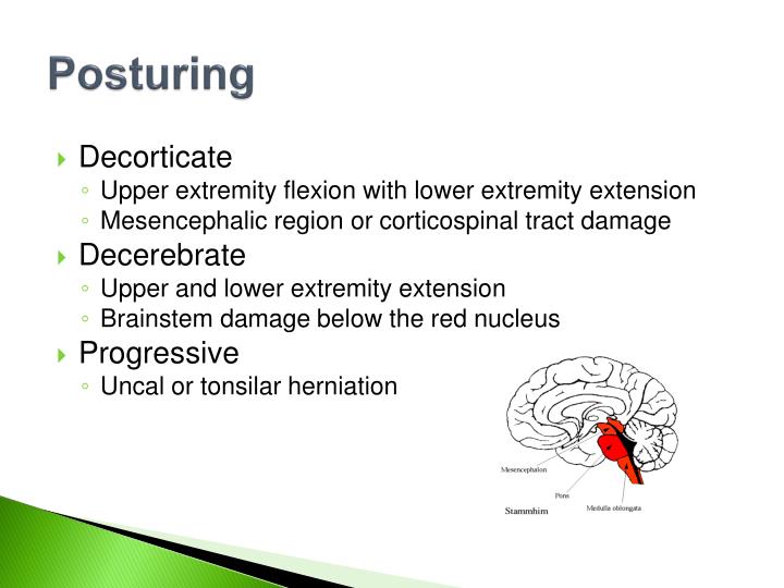 Brain Injury Signs And Symptoms Of Head Abnormal Posturing Decorticate