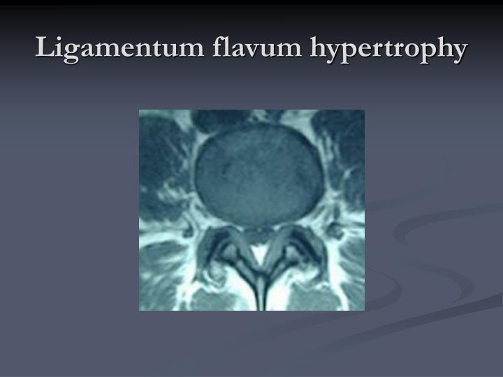PPT Osteoarthritis PowerPoint Presentation ID6675637