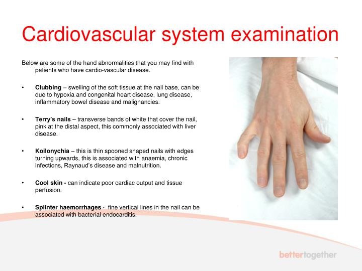 PPT UWE Bristol Cardiovascular system examination PowerPoint(09)