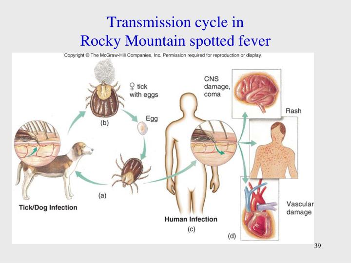 rocky mountain spotted fever bacteria diagram