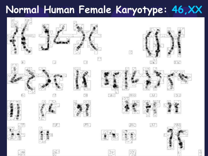 Ppt Pedigrees And Karyotypes Powerpoint Presentation Id 6770214