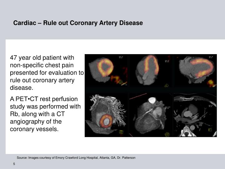pet ct cardiac perfusion rest and stress