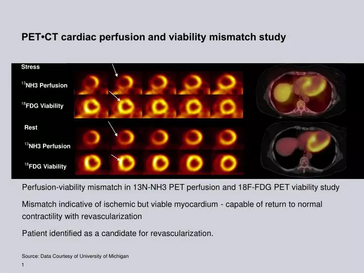 regadenoson cardiac pet ct perfusion