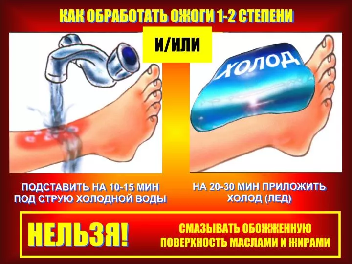 Прическа на каждый день Перикоронит удаление капюшона зуба мудрости, если