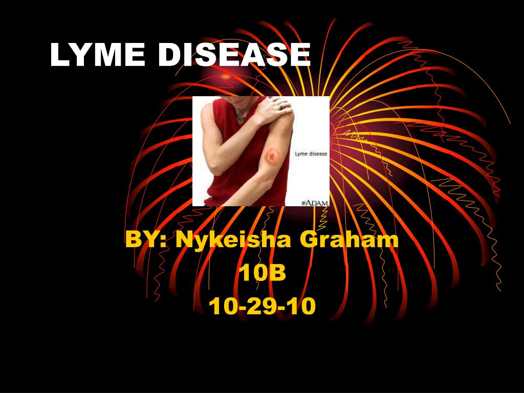 PPT LYME DISEASE PowerPoint Presentation, free download ID5376286