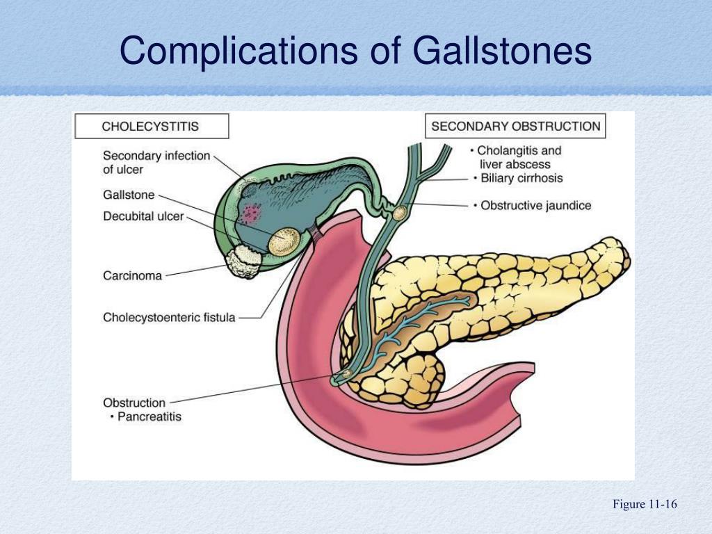 PPT - Endocrine, Reproductive and Urinary System Review PowerPoint