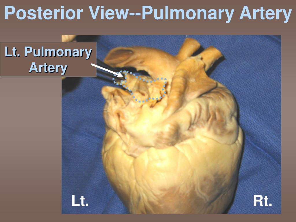 PPT - Sheep Heart Dissection 101 PowerPoint Presentation, free download