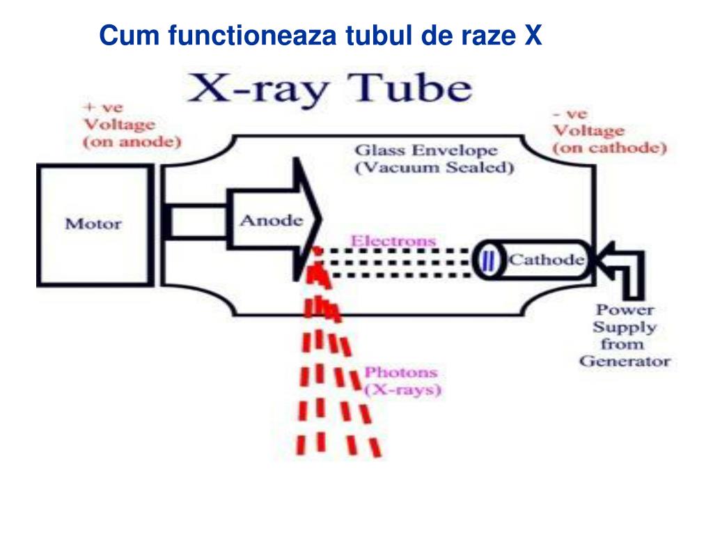 PPT - Descoperirea radiatiilor X si utilizarea lor PowerPoint Presentation  - ID:5400703