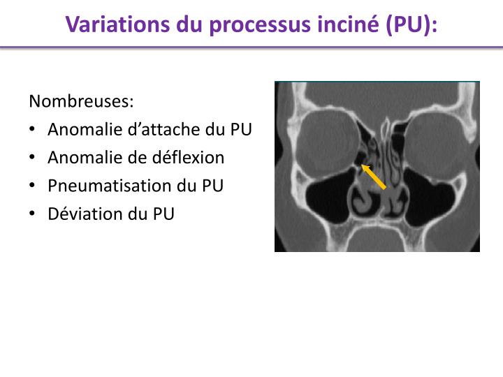 PPT - HEAD AND NECK : HN 16 PowerPoint Presentation - ID:5409000