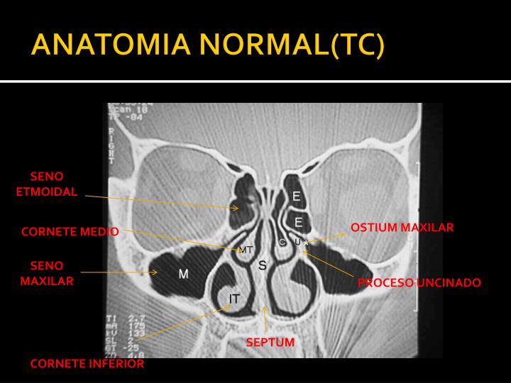 PPT Repaso Cabeza y Cuello PowerPoint Presentation ID5409983