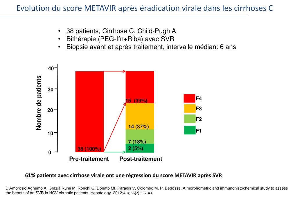 PPT R gression De La Cirrhose De La Physiopathologie La Clinique PPT R gression De La Cirrhose De La Physiopathologie La Clinique