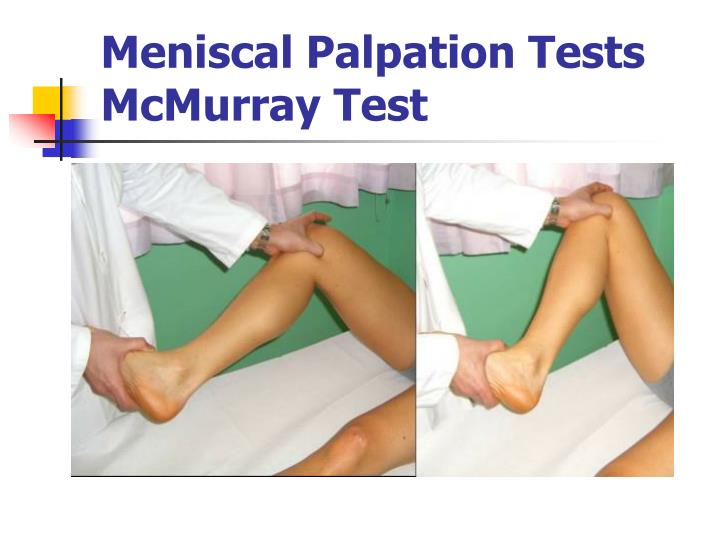 Mcmurray Testing PPT - Clinical examination of the knee H.Mousavi Tadi,MD Department of ...