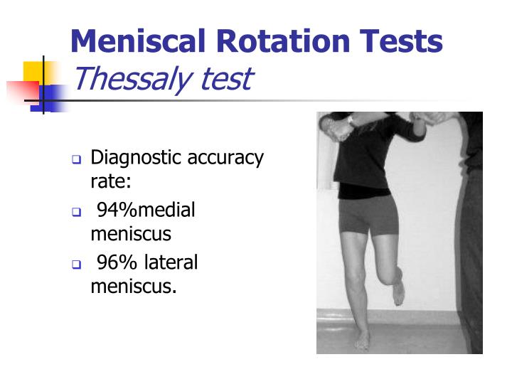 PPT Clinical examination of the knee H.Mousavi Tadi,MD Department of