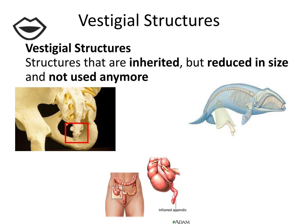 download vestigial structures download vestigial structures