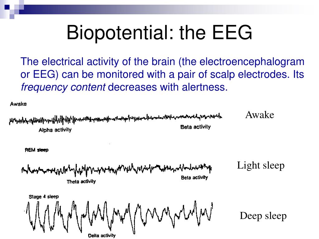 PPT - Biomedical Signal Processing An introduction PowerPoint ...