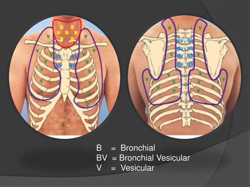 vesicular breath sounds noted bilaterally in peripheral vesicular breath sounds noted bilaterally in peripheral