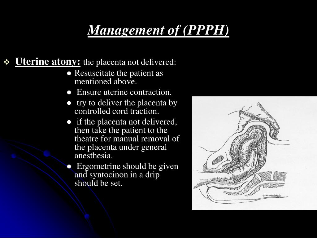PPT - Third stage of labour (Normal & abnormal) PowerPoint Presentation  - ID:5439113
