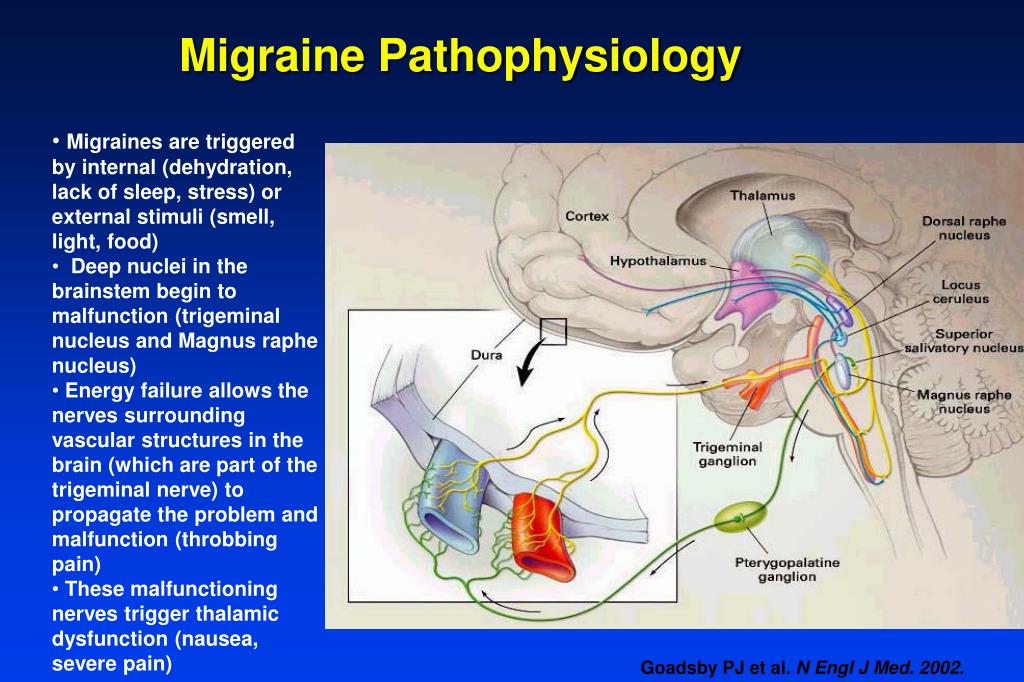 PPT Living With Headaches PowerPoint Presentation Free Download ID PPT Living With Headaches PowerPoint Presentation Free Download ID