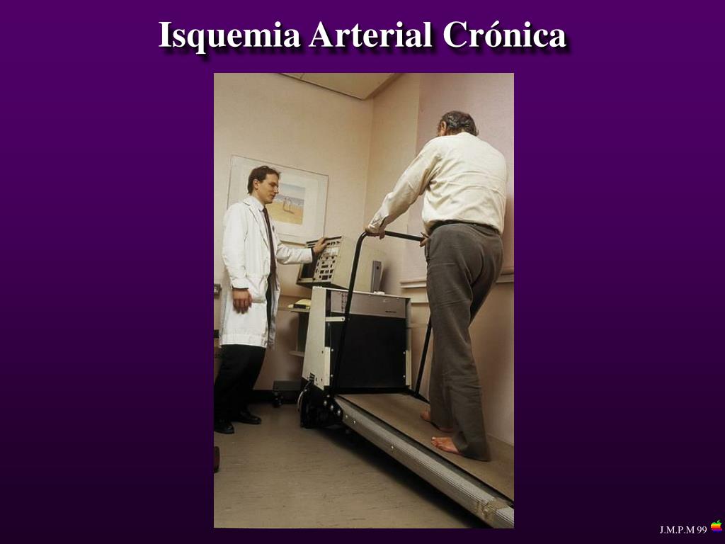 Ppt Isquemia Arterial Crónica Powerpoint Presentation Free Download Id5440568 9418