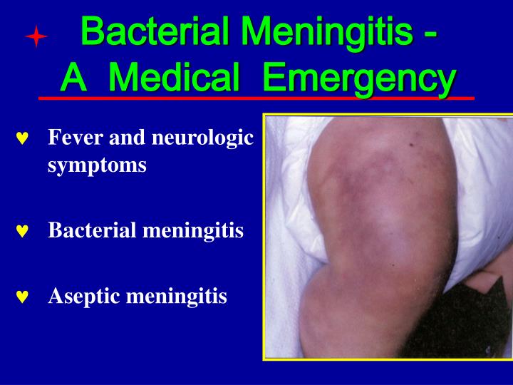PPT - Bacterial Meningitis - A Medical Emergency ...