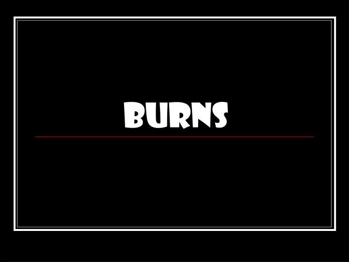 burns n.