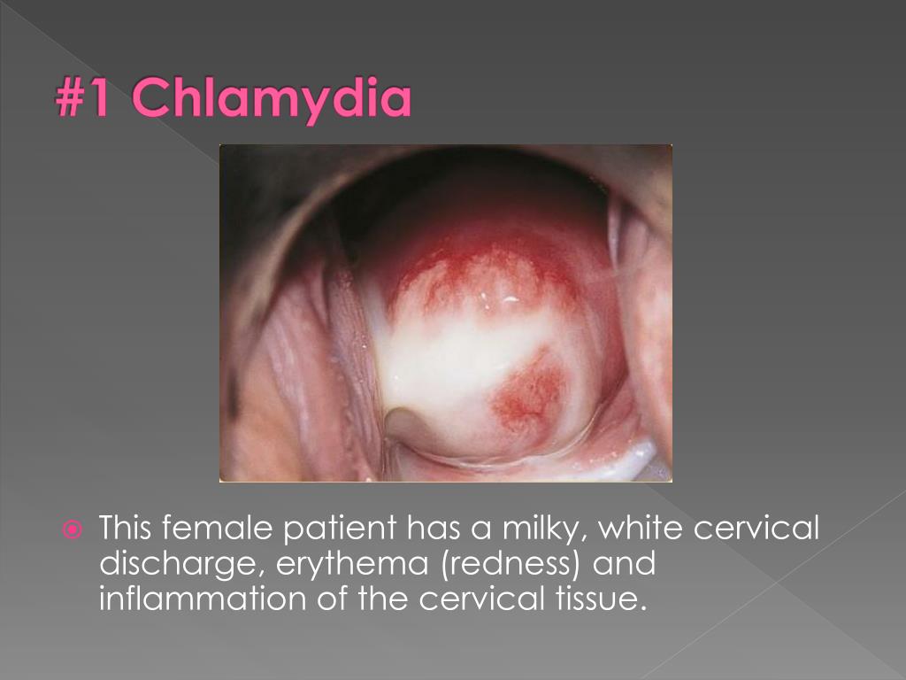 PPT - Common STDs Among Teenagers: Understanding Risks and Symptoms ...
